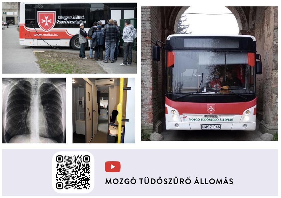 Mozgó Tüdőgondozó és Tüdőszűrő Állomás